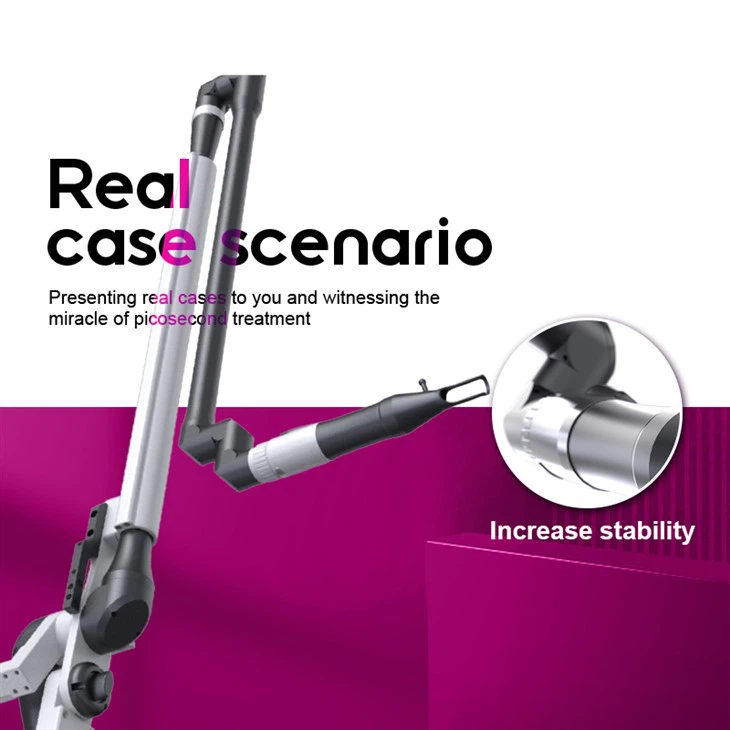 Laser Pigmentation Removal Machine